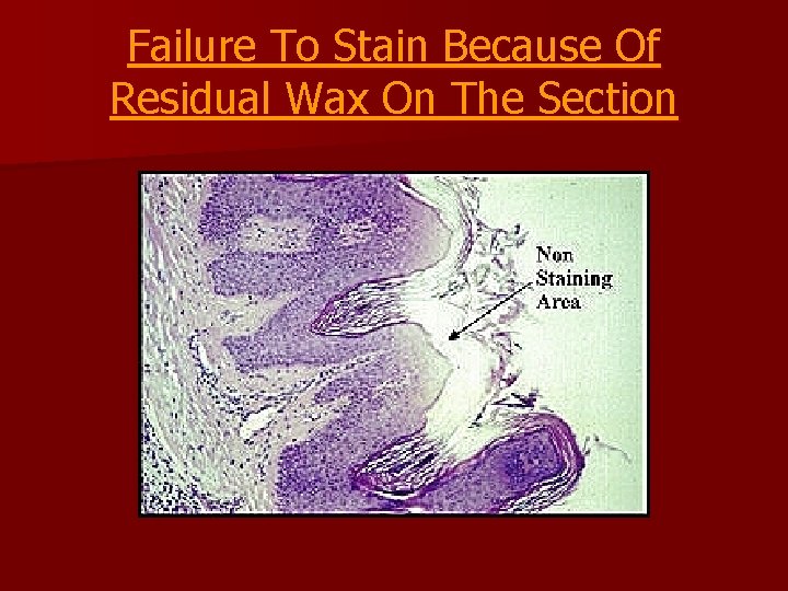 Failure To Stain Because Of Residual Wax On The Section 