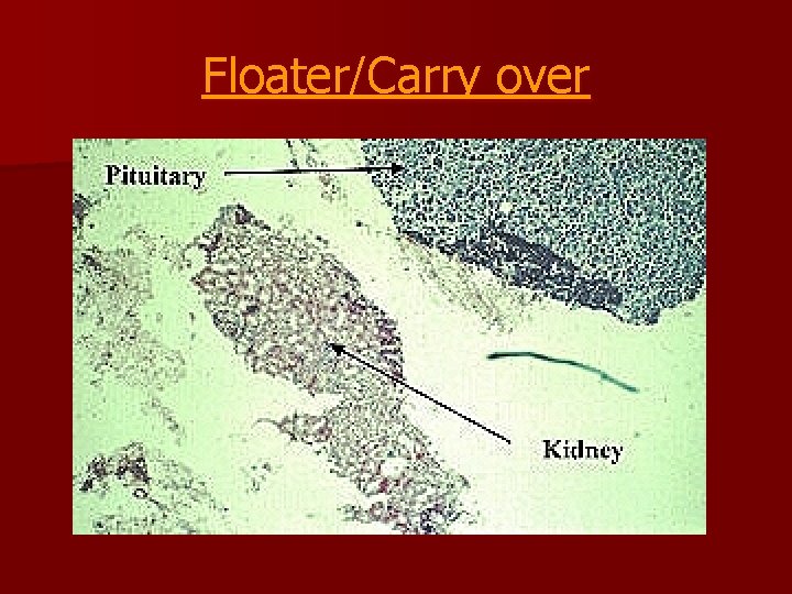 Floater/Carry over 