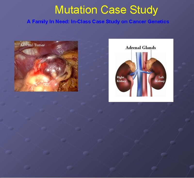 Mutation Case Study A Family In Need: In-Class Case Study on Cancer Genetics 