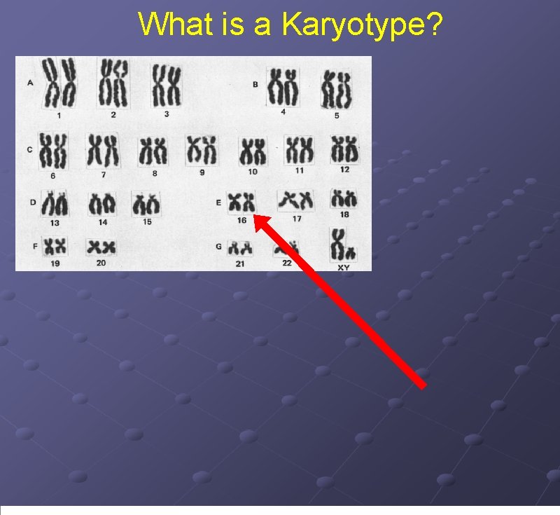 What is a Karyotype? 