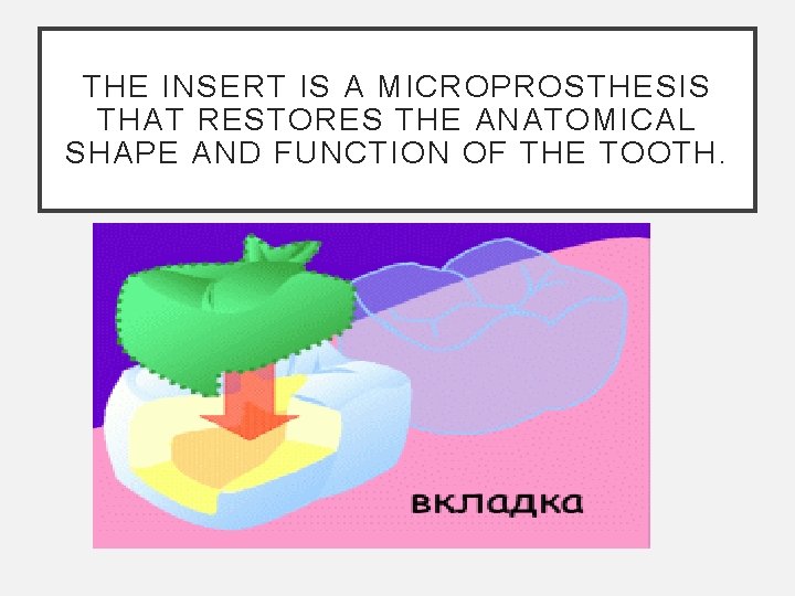 THE INSERT IS A MICROPROSTHESIS THAT RESTORES THE ANATOMICAL SHAPE AND FUNCTION OF THE