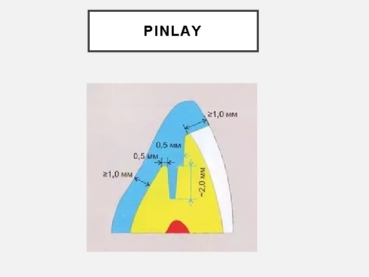 PINLAY 