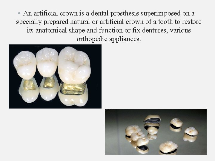  • An artificial crown is a dental prosthesis superimposed on a specially prepared