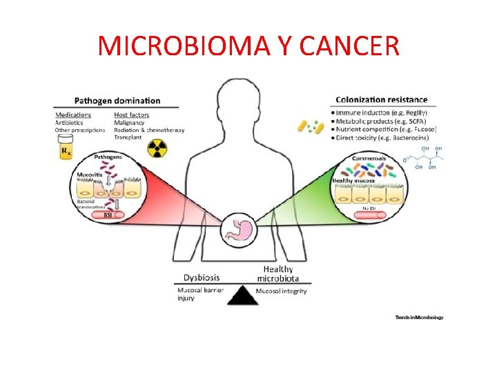 MICROBIOMA Y CANCER 