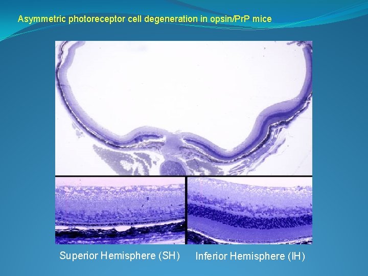 Asymmetric photoreceptor cell degeneration in opsin/Pr. P mice Superior Hemisphere (SH) Inferior Hemisphere (IH)