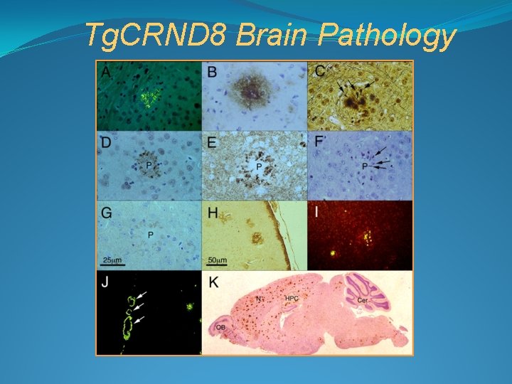 Tg. CRND 8 Brain Pathology 