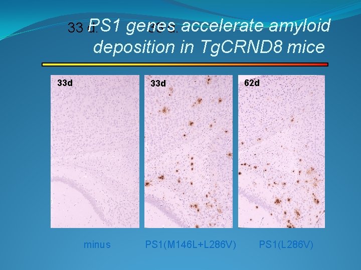 33 PS 1 d. genes 33 d. accelerate amyloid deposition in Tg. CRND 8