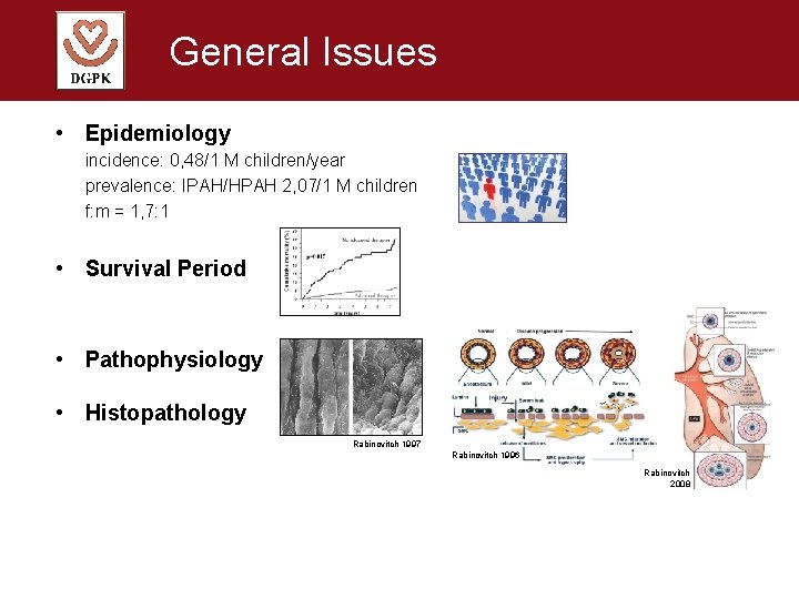 General Issues • Epidemiology incidence: 0, 48/1 M children/year prevalence: IPAH/HPAH 2, 07/1 M