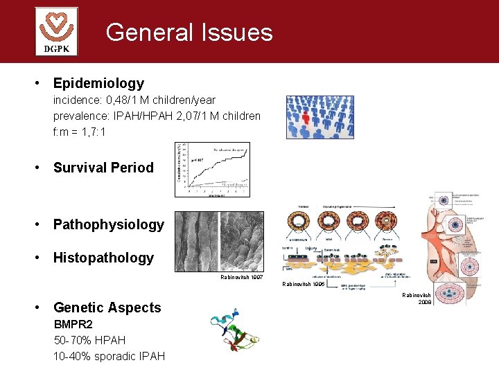 General Issues • Epidemiology incidence: 0, 48/1 M children/year prevalence: IPAH/HPAH 2, 07/1 M