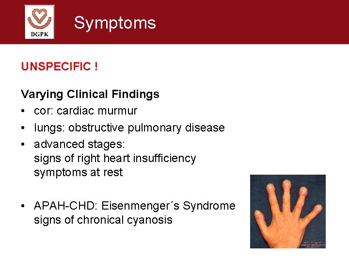 Symptoms UNSPECIFIC ! Varying Clinical Findings • cor: cardiac murmur • lungs: obstructive pulmonary