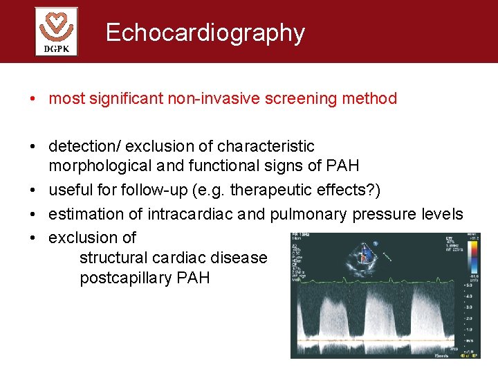 Echocardiography • most significant non-invasive screening method • detection/ exclusion of characteristic morphological and