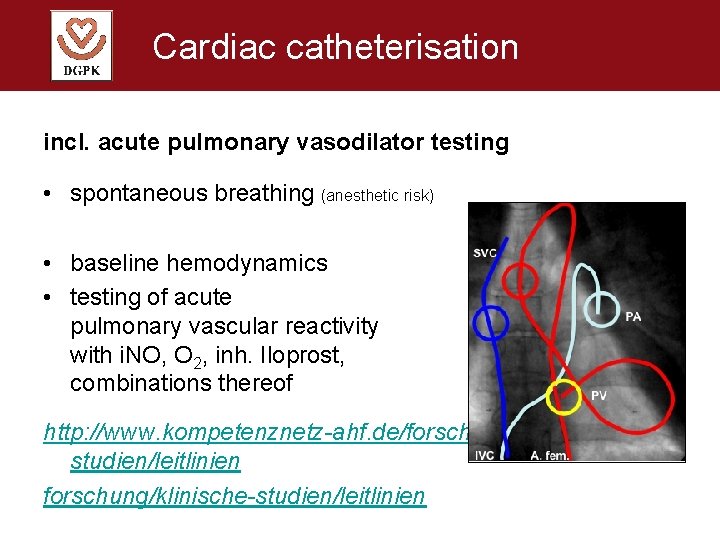 Cardiac catheterisation incl. acute pulmonary vasodilator testing • spontaneous breathing (anesthetic risk) • baseline