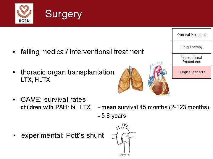 Surgery General Measures • failing medical/ interventional treatment • thoracic organ transplantation Drug Therapy