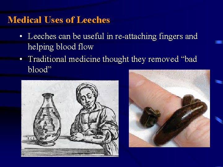 Medical Uses of Leeches • Leeches can be useful in re-attaching fingers and helping