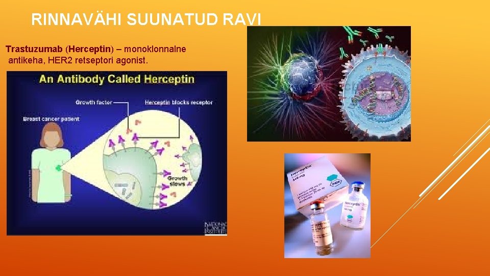 RINNAVÄHI SUUNATUD RAVI Trastuzumab (Herceptin) – monoklonnalne antikeha, HER 2 retseptori agonist. 