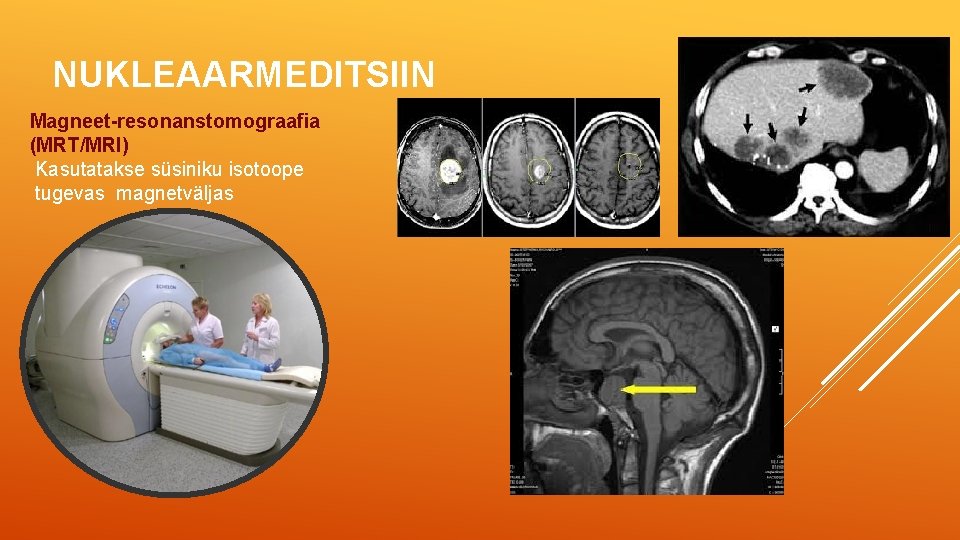 NUKLEAARMEDITSIIN Magneet-resonanstomograafia (MRT/MRI) Kasutatakse süsiniku isotoope tugevas magnetväljas 