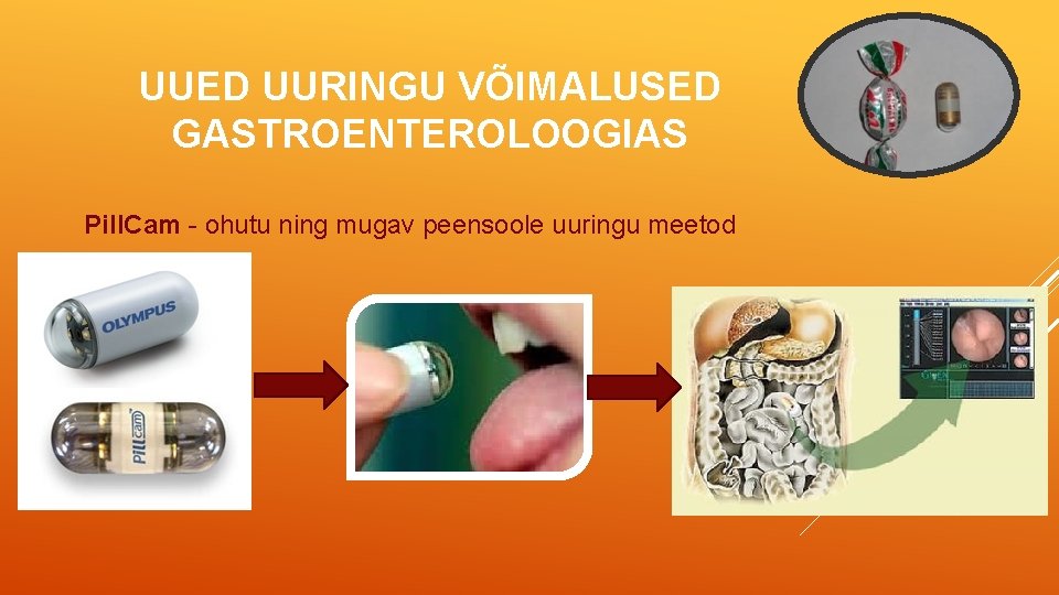 UUED UURINGU VÕIMALUSED GASTROENTEROLOOGIAS Pill. Cam - ohutu ning mugav peensoole uuringu meetod 