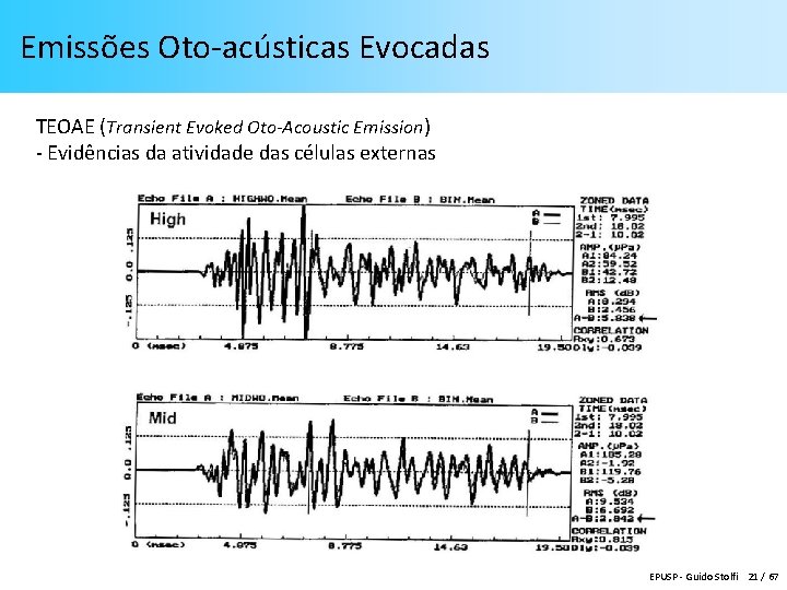 Emissões Oto-acústicas Evocadas TEOAE (Transient Evoked Oto-Acoustic Emission) - Evidências da atividade das células