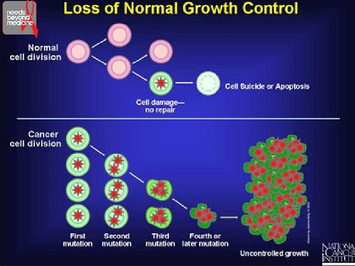 How Does Cancer Start? 