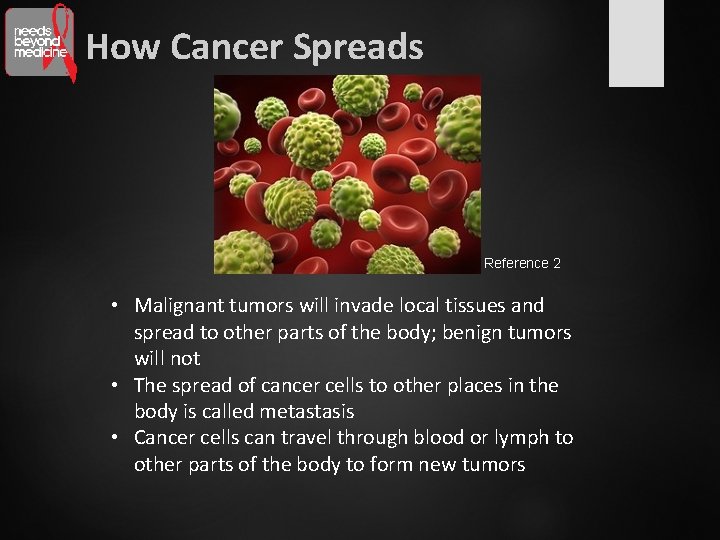 How Cancer Spreads Reference 2 • Malignant tumors will invade local tissues and spread