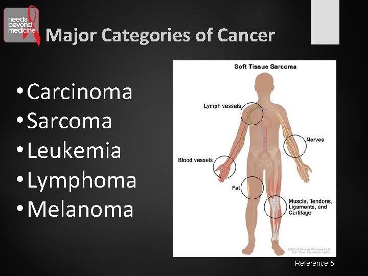 Major Categories of Cancer • Carcinoma • Sarcoma • Leukemia • Lymphoma • Melanoma