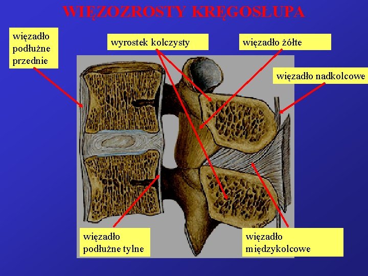 WIĘZOZROSTY KRĘGOSŁUPA więzadło podłużne przednie wyrostek kolczysty więzadło żółte więzadło nadkolcowe więzadło podłużne tylne