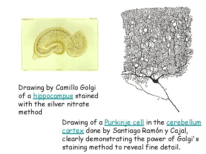 Drawing by Camillo Golgi of a hippocampus stained with the silver nitrate method Drawing Drawing by Camillo Golgi of a hippocampus stained with the silver nitrate method Drawing