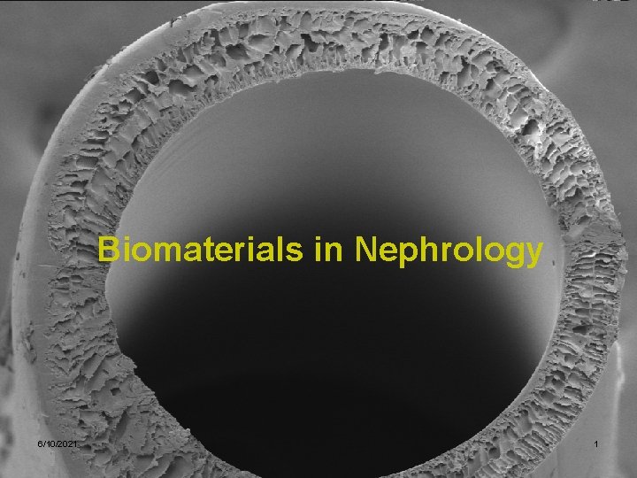 Biomaterials in Nephrology 6/10/2021 1 