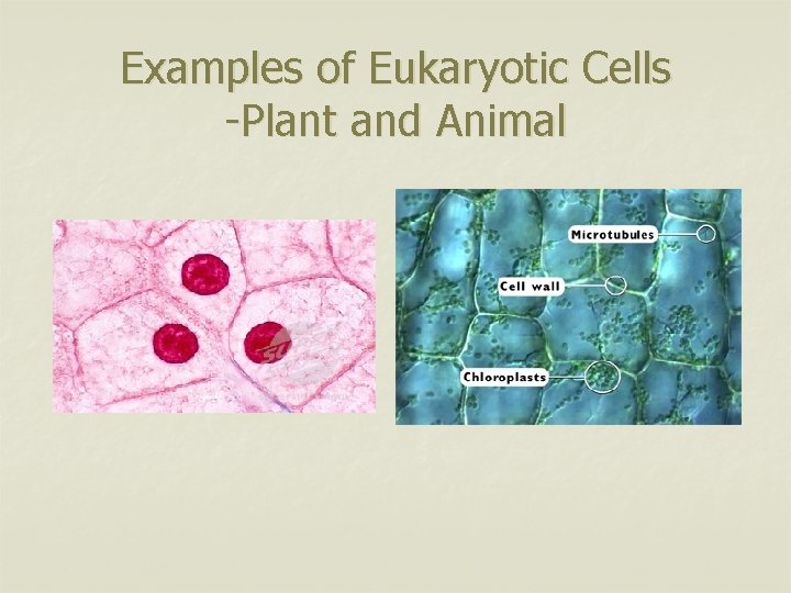 Examples of Eukaryotic Cells -Plant and Animal 