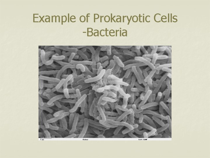 Example of Prokaryotic Cells -Bacteria 