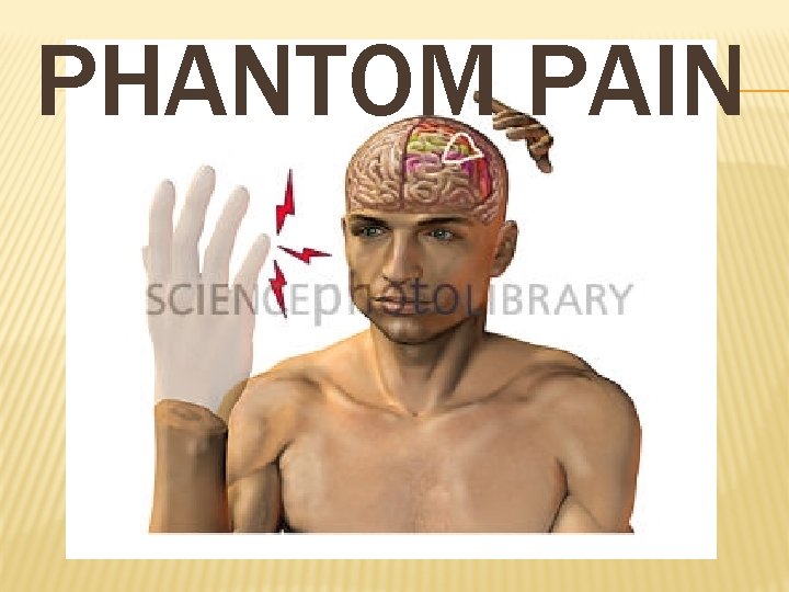 PHANTOM PAIN 