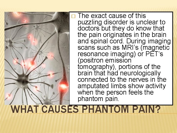 � The exact cause of this puzzling disorder is unclear to doctors but they