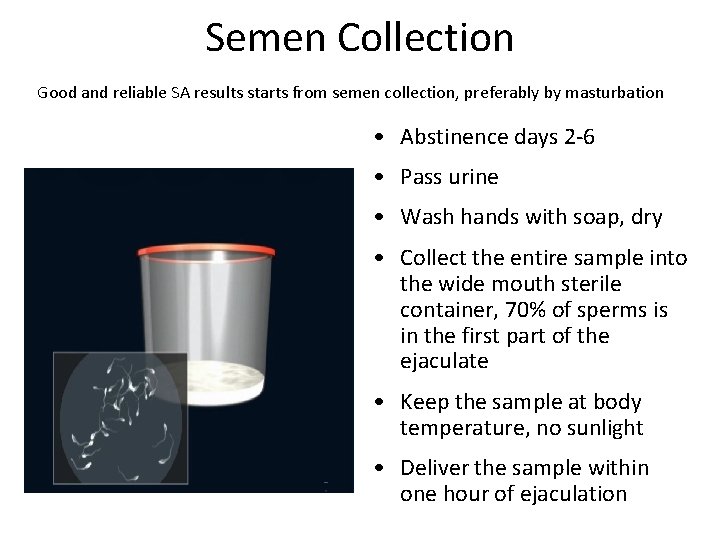 Semen Collection Good and reliable SA results starts from semen collection, preferably by masturbation