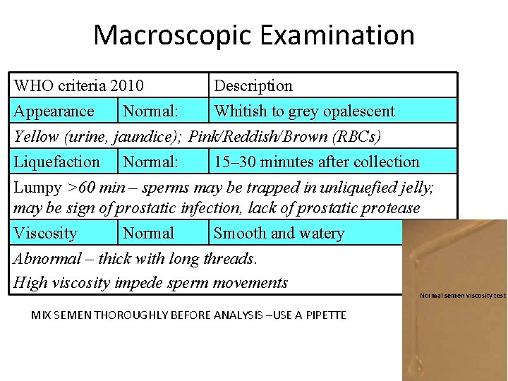 Macroscopic Examination WHO criteria 2010 Description Appearance Normal: Whitish to grey opalescent Yellow (urine,