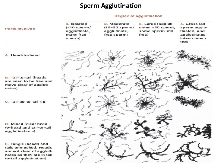 Sperm Agglutination 