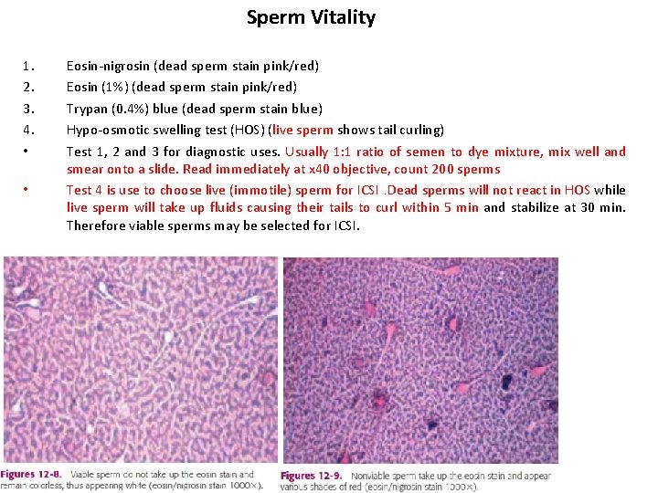 Sperm Vitality 1. 2. 3. 4. • • Eosin-nigrosin (dead sperm stain pink/red) Eosin