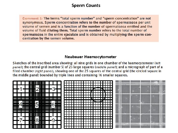 Sperm Counts Neubauer Haemocytometer 