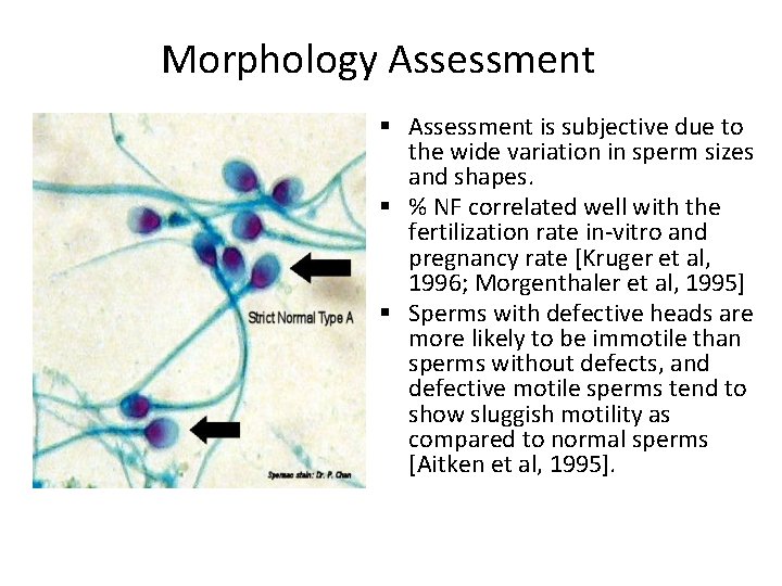 Morphology Assessment § Assessment is subjective due to the wide variation in sperm sizes