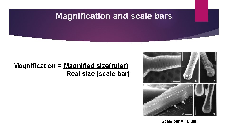 Magnification and scale bars Magnification = Magnified size(ruler) Real size (scale bar) Scale bar