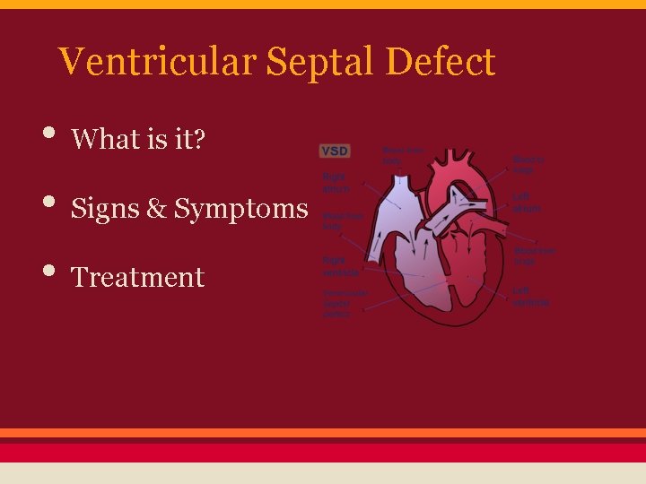 Ventricular Septal Defect • What is it? • Signs & Symptoms • Treatment 