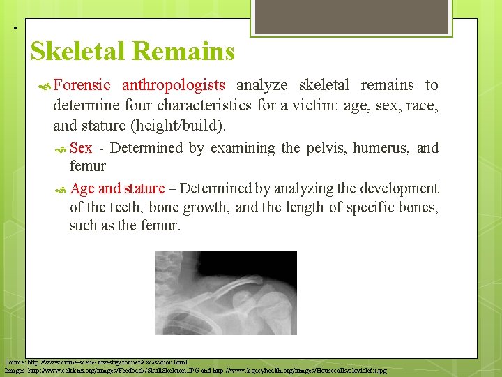 • Skeletal Remains Forensic anthropologists analyze skeletal remains to determine four characteristics for • Skeletal Remains Forensic anthropologists analyze skeletal remains to determine four characteristics for