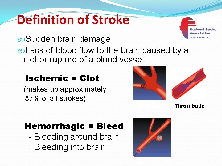 Definition of Stroke Sudden brain damage Lack of blood flow to the brain caused
