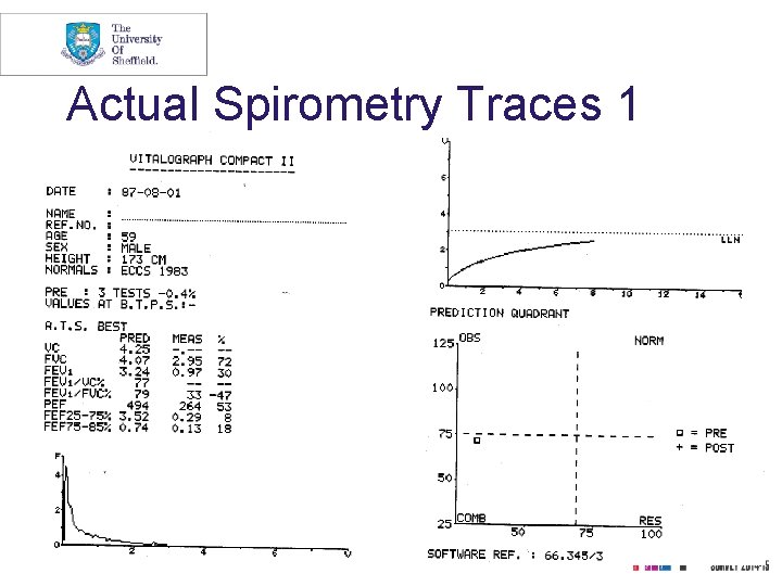 Actual Spirometry Traces 1 