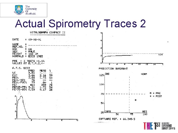 Actual Spirometry Traces 2 