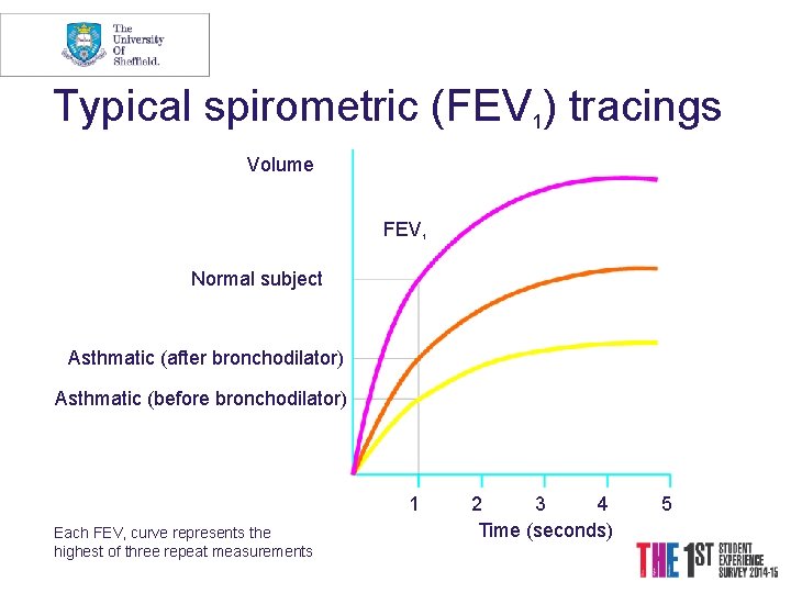 Typical spirometric (FEV 1) tracings Volume FEV 1 Normal subject Asthmatic (after bronchodilator) Asthmatic