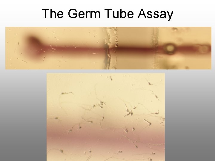 The Germ Tube Assay 