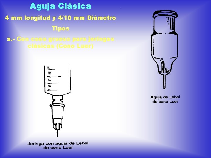 Aguja Clásica 4 mm longitud y 4/10 mm Diámetro Tipos a. - Con cono Aguja Clásica 4 mm longitud y 4/10 mm Diámetro Tipos a. - Con cono