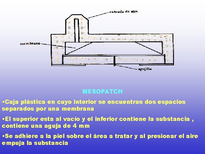 MESOPATCH • Caja plástica en cuyo interior se encuentran dos espacios separados por una MESOPATCH • Caja plástica en cuyo interior se encuentran dos espacios separados por una