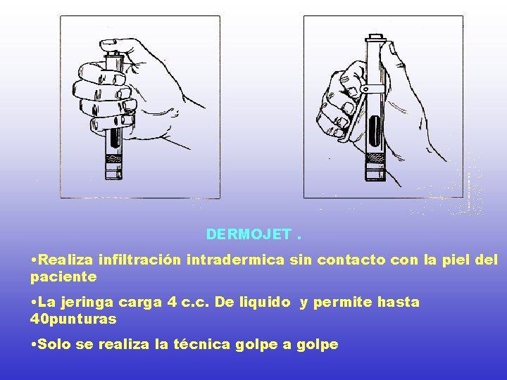 DERMOJET. • Realiza infiltración intradermica sin contacto con la piel del paciente • La DERMOJET. • Realiza infiltración intradermica sin contacto con la piel del paciente • La