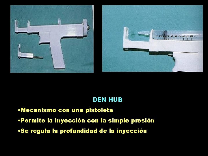 DEN HUB • Mecanismo con una pistoleta • Permite la inyección con la simple DEN HUB • Mecanismo con una pistoleta • Permite la inyección con la simple